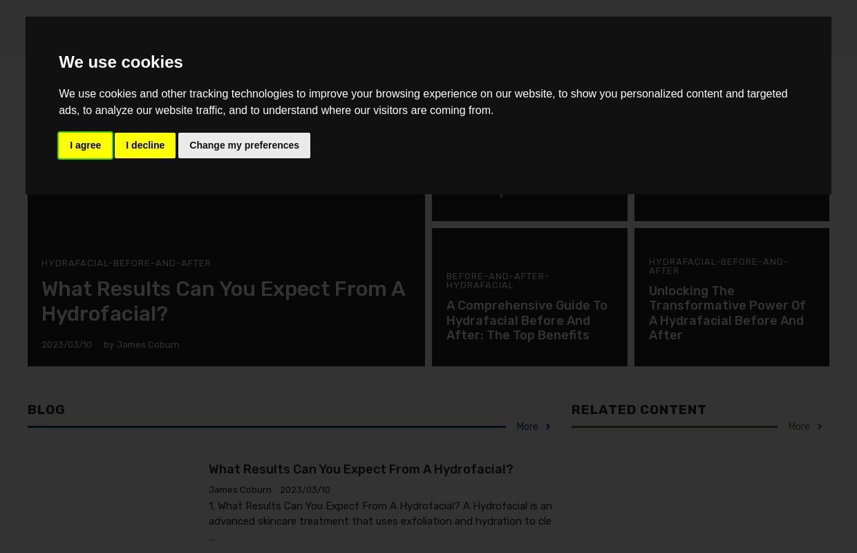 hydrafacial before and after 