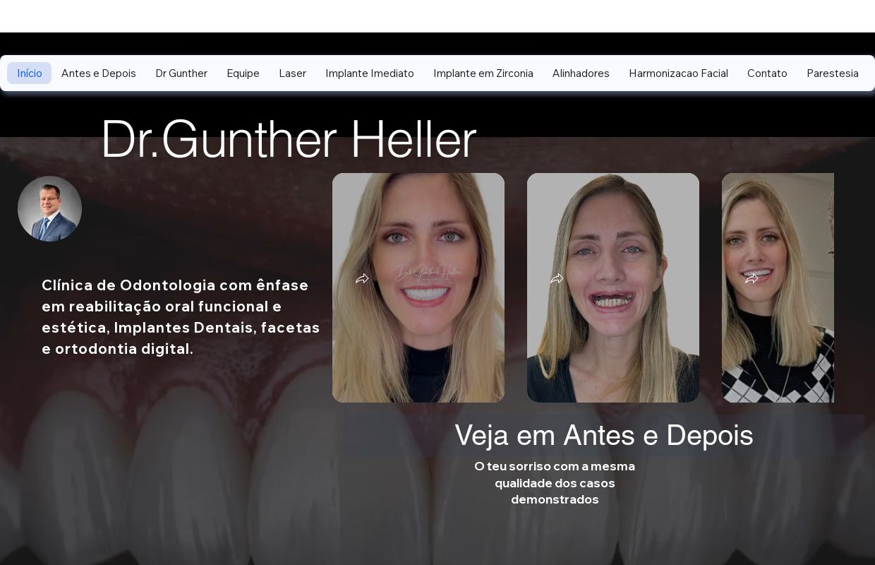 Clinica Implante Dentario, Facetas e Laser | Dr Gunther Heller